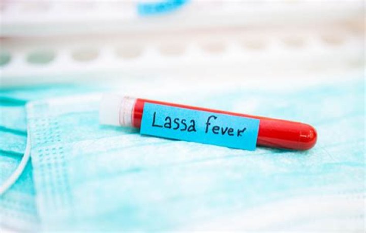 
Death toll of Lassa fever rises to 171 in Nigeria 