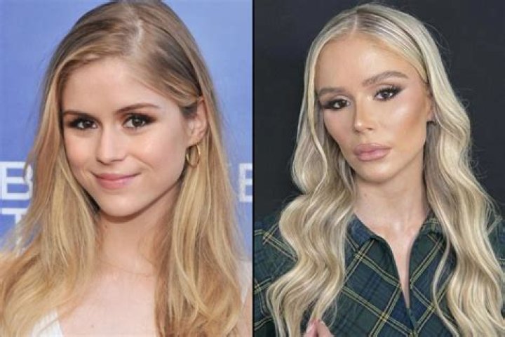 
Did Summer Walker Get Plastic Surgery? Here Is Why The Singer Looks So Different 