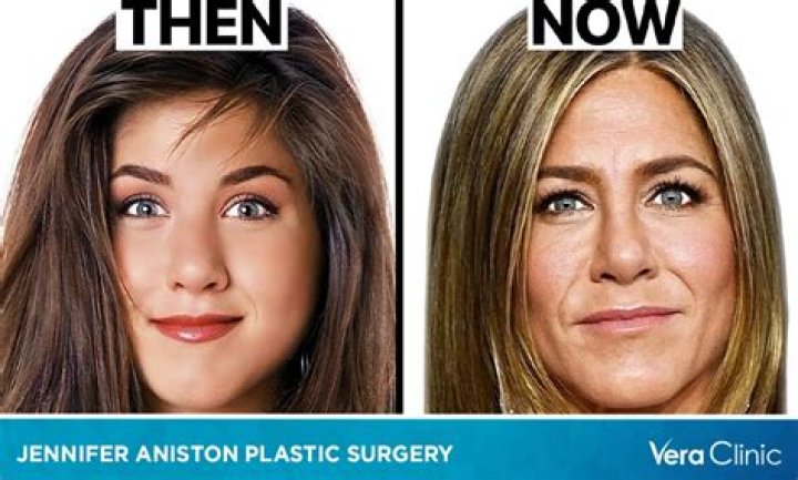 
Has Jennifer Grey Had Plastic Surgery? Before And After Photos On Twitter 