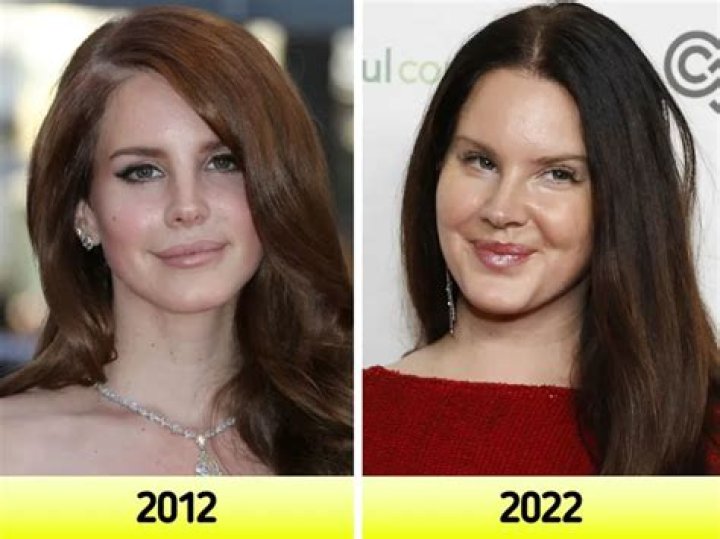 Lana Del Rey Weight Gain Facts- What Happened To Her Instagram?