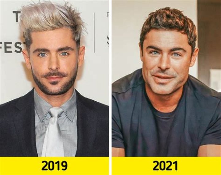 
What Happened To Patty Gasso Face? Plastic Surgery Rumors Addressed 